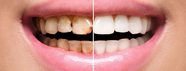 Cosmetic Dentistry St George UT